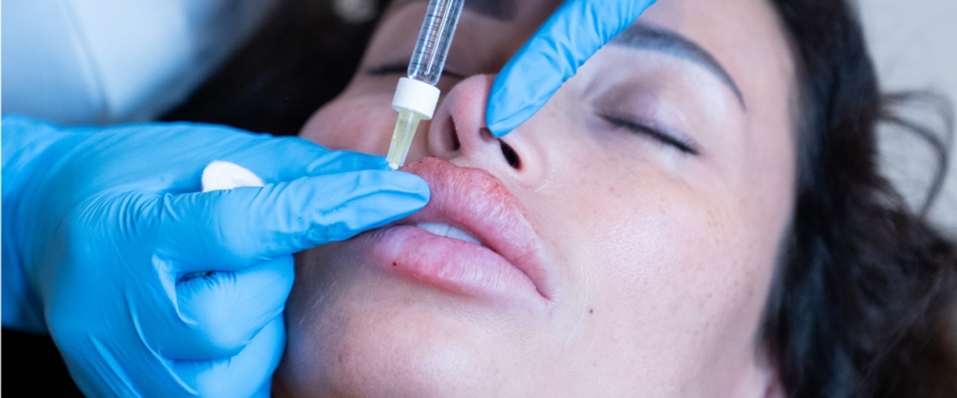 What are examples of aesthetic treatments?