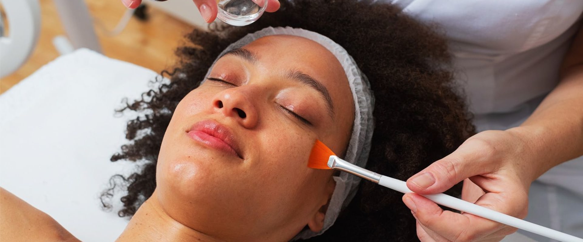 A Comprehensive Guide to Chemical Peels for Non-Surgical Facial Rejuvenation