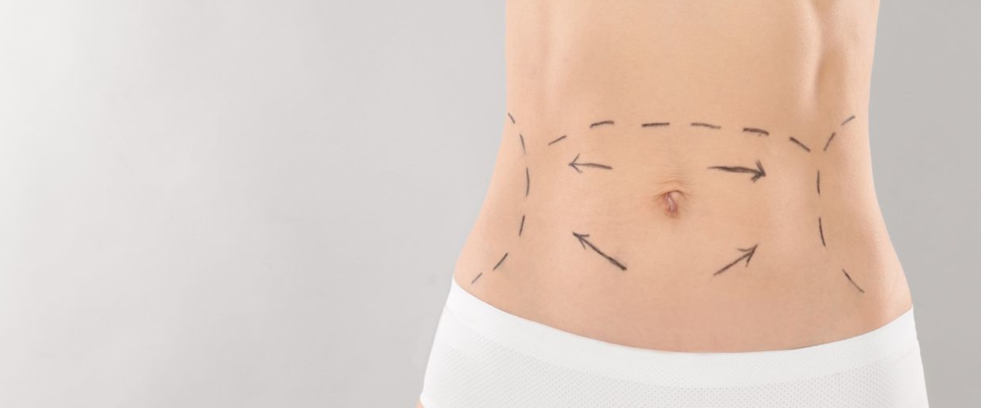 How many inches does coolsculpting take off?