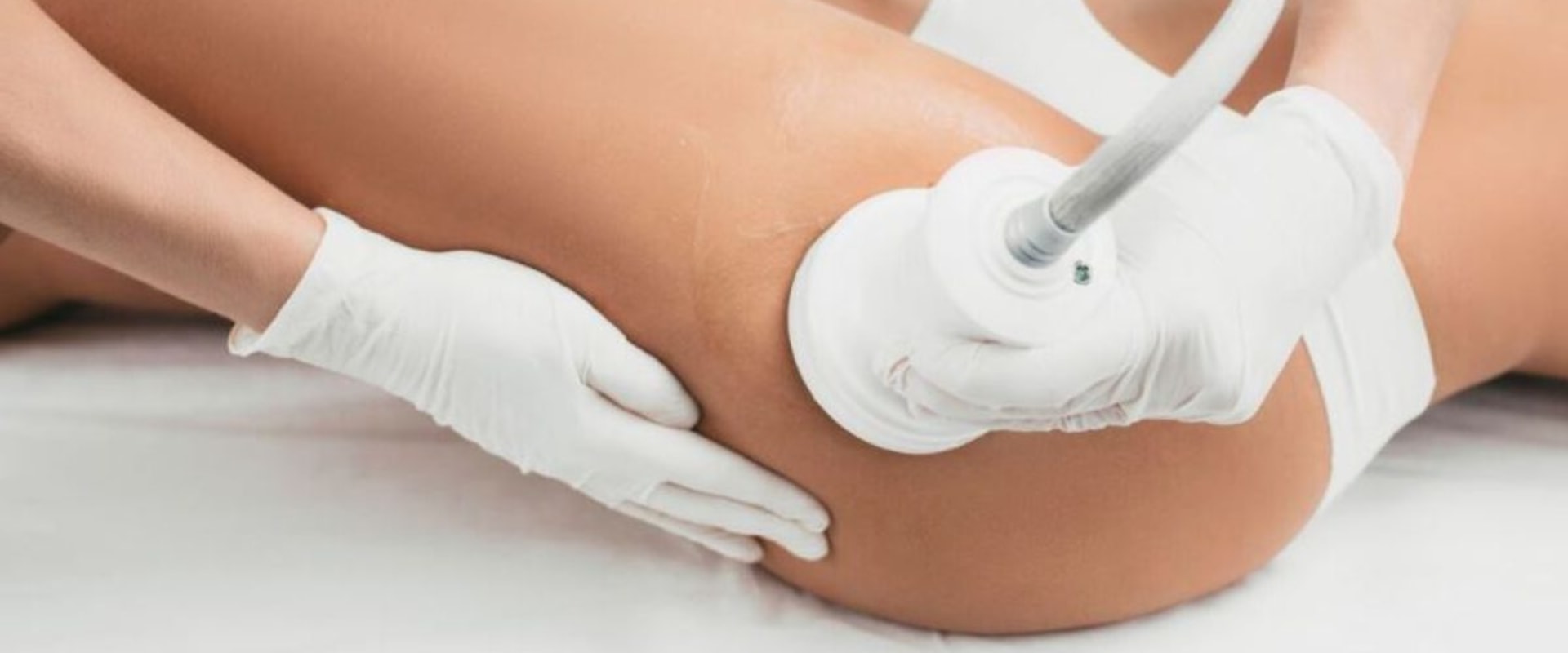 VelaShape: The Ultimate Non-Surgical Body Contouring Solution