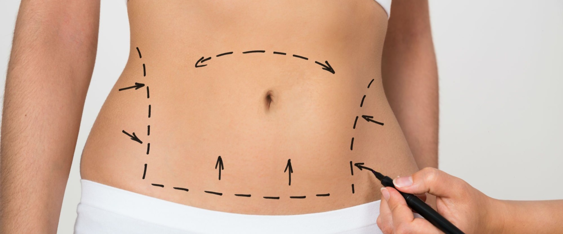 Can you tighten loose stomach skin?