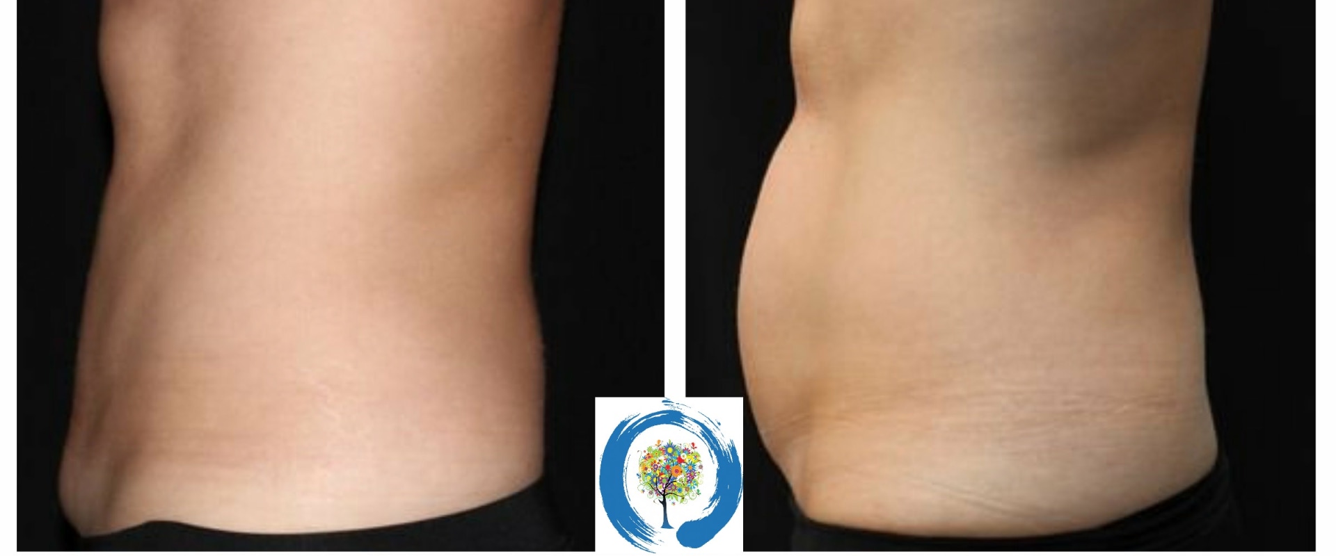 How deep does coolsculpting go?