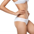 Everything You Need to Know About SculpSure: A Non-Surgical Body Contouring Option for Achieving Your Dream Body