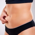 Does coolsculpting work if you are overweight?