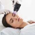 Exploring Radiofrequency Skin Tightening: Everything You Need to Know