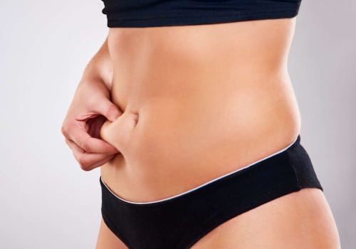 Does coolsculpting work if you are overweight?