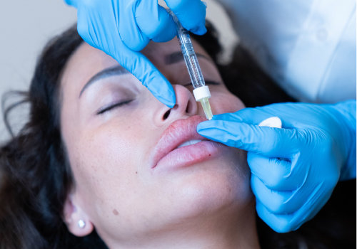 What are examples of aesthetic treatments?