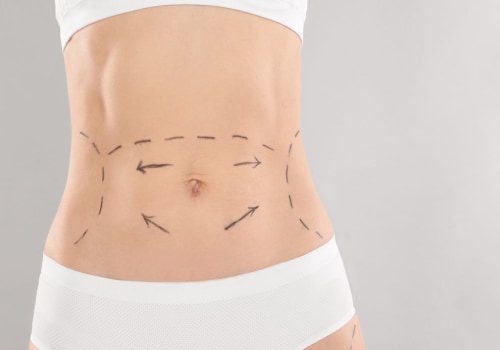 How many inches does coolsculpting take off?