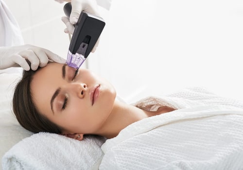 Exploring Radiofrequency Skin Tightening: Everything You Need to Know